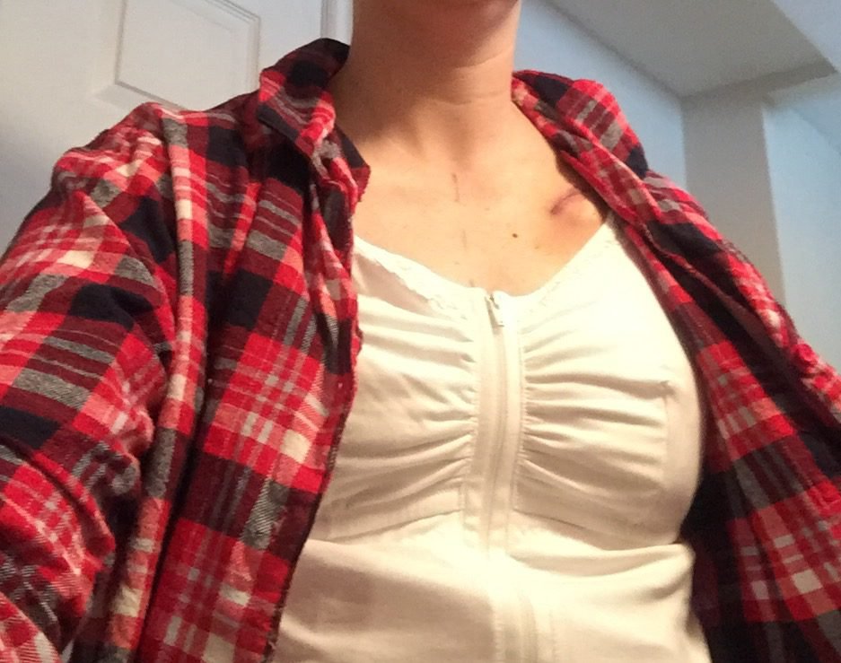 What You ACTUALLY Need for Mastectomy Recovery Mommy Standard Time