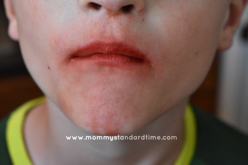 skinstainsbefore Mommy Standard Time